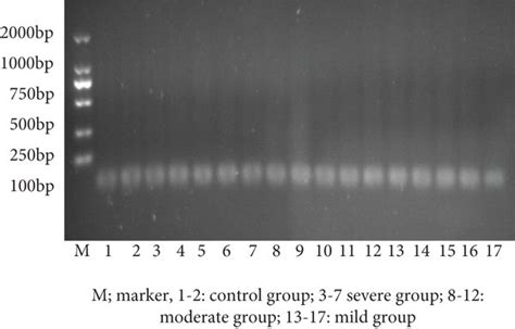 Cdna Gel Image