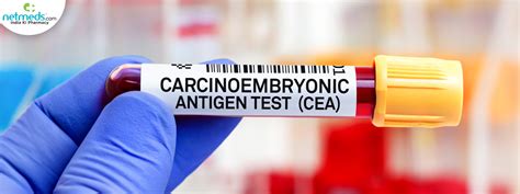 What Does a High CEA Antigen Blood Test Result Mean for Your Health?