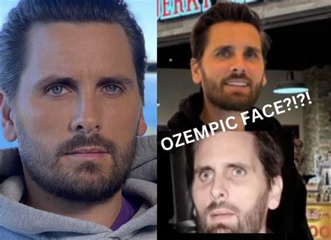 Celebrities with Ozempic Face: 7 Shocking Examples Uncovered