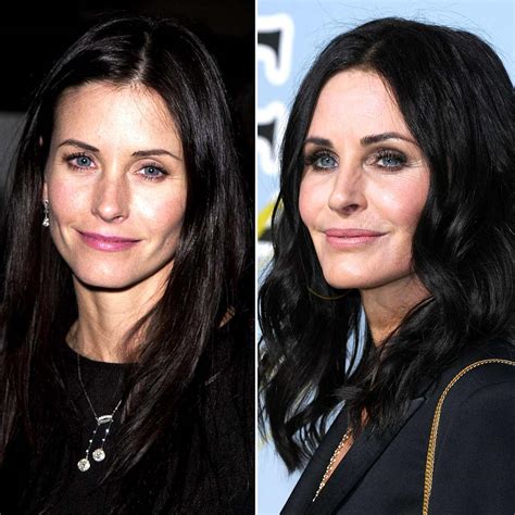 celebrity plastic surgery