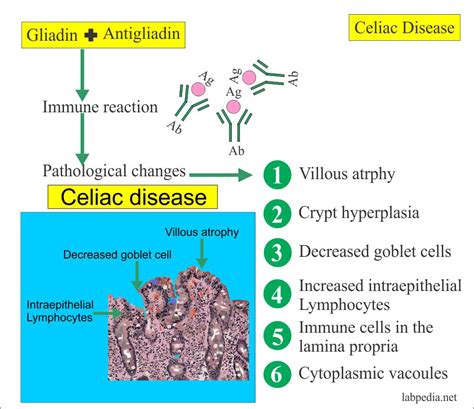 celiac disease tissue transglutaminase iga