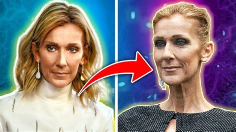 celine dion health what happened