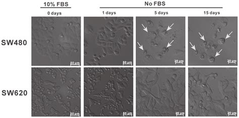Cell Culture Without Fbs