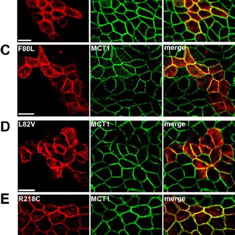 cell membrane marker