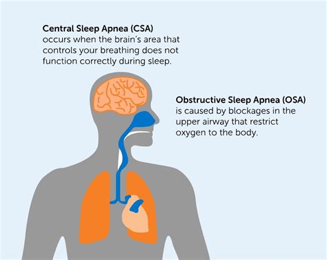 central and obstructive sleep apnea