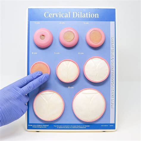 Cervical Dilation Without Checking