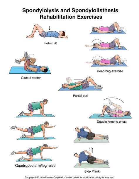 cervical spondylolisthesis physical therapy