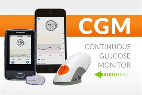 cgm floor monitors