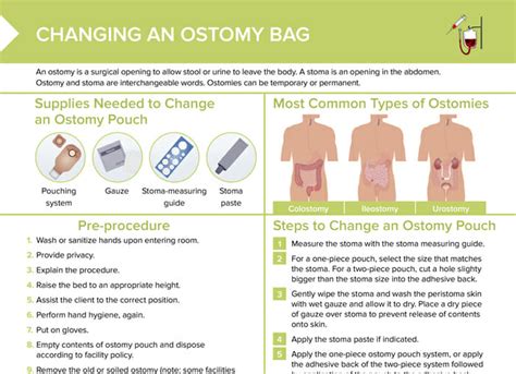 Changing An Ostomy Bag Steps