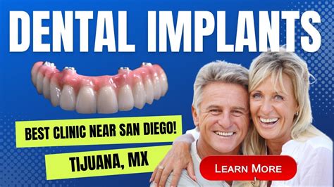 cheapest all on 4 implants