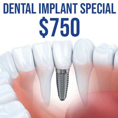 cheapest dental implants north east