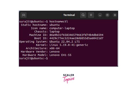 check dns server configuration linux