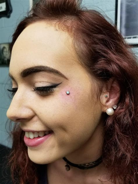 Cheek Dermal