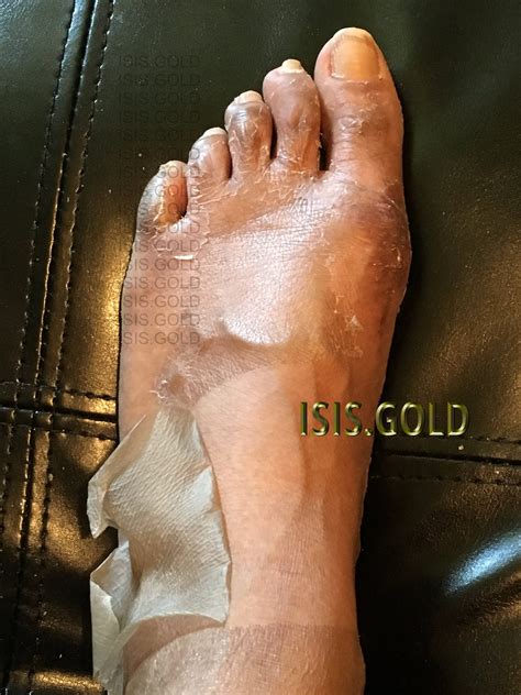 I Tried A Chemical Foot Peel For The First Time Macro Beauty