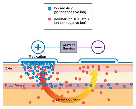 Chemical Desincrustation And Ionic Iontophoresis Is Created By A