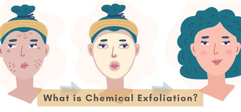 Chemical Exfoliation Process