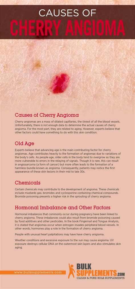 Cherry Angioma
