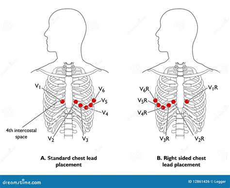 Chest Leads Ecg