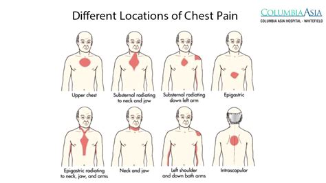 Chest Pain Before Burping