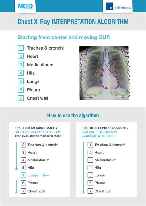 Chest X Ray Algorithm