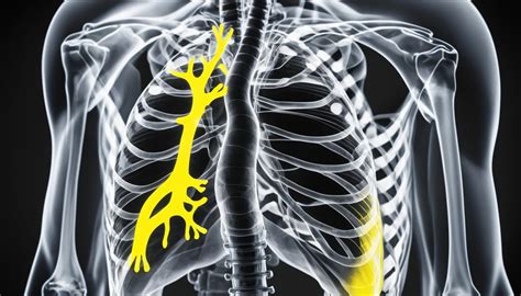 Chest X Ray Decubitus View Cpt Code