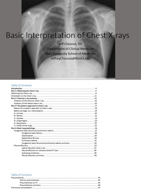 Chest X Ray Interpretation Pdf