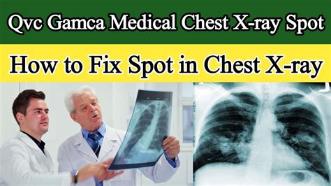 Chest X Ray Qatar