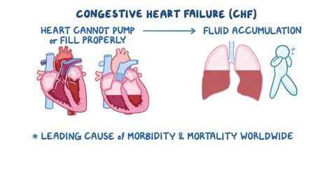 chf and fatigue