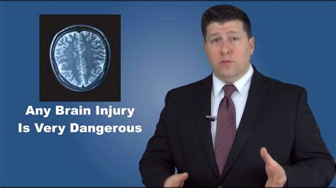 chicago brain injury lawyer