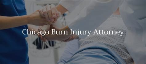 chicago burn injury attorney