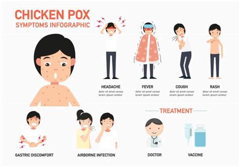 chicken pox nsw health