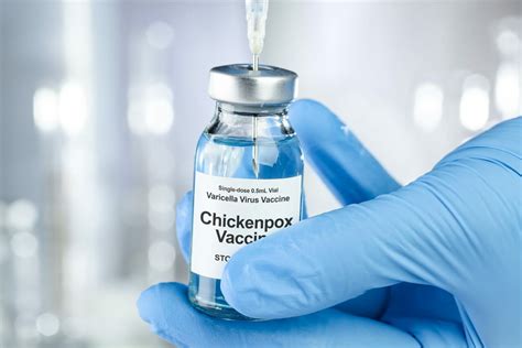 chicken pox post vaccine