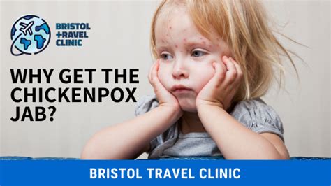 Chickenpox Jab