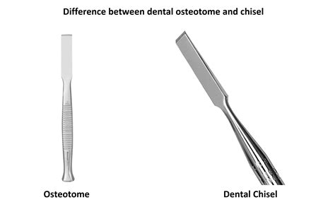 Chisel Vs Osteotome