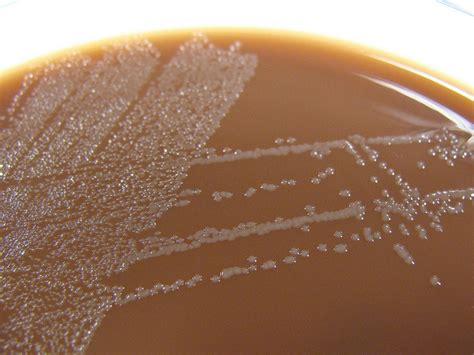 Chocolate Agar Haemophilus Influenzae