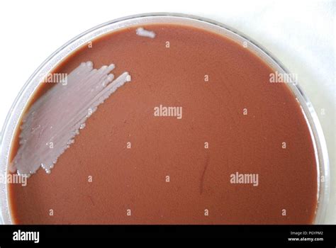 Chocolate Agar Morphology