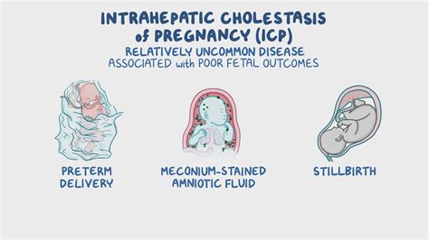 Cholestasis Test Pregnancy