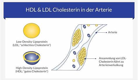 Frisch Warum Cholesterin Zu Hoch