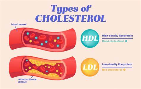 Cholesterol Elevated