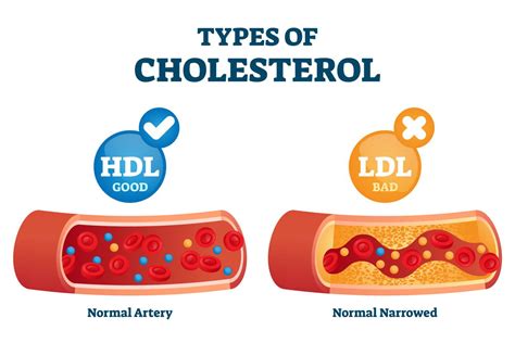 cholesterol hdl ldl difference