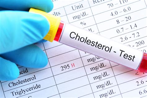 Cholesterol How Often To Check