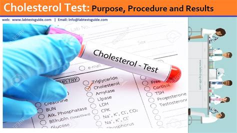 Cholesterol Test Requirements
