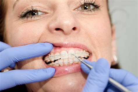 choosing orthodontist