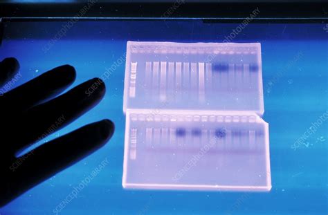 Chromatography Of Dna