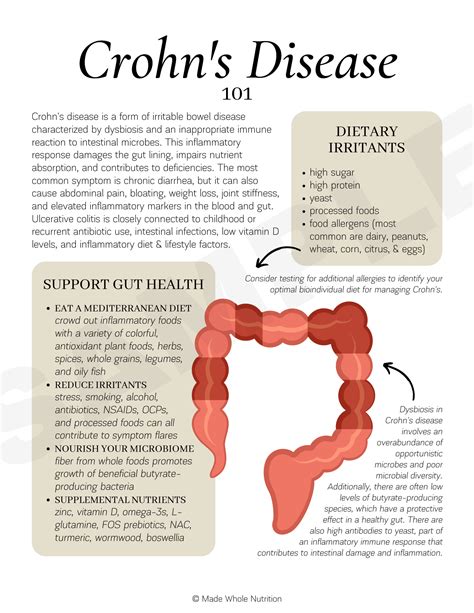 Chrones Disease Printable Information