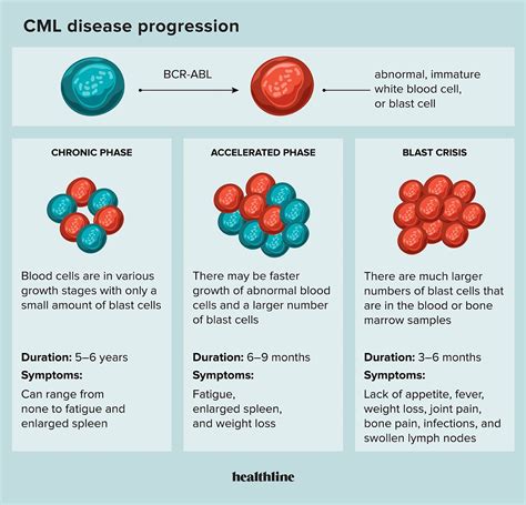 chronic leukemia cml