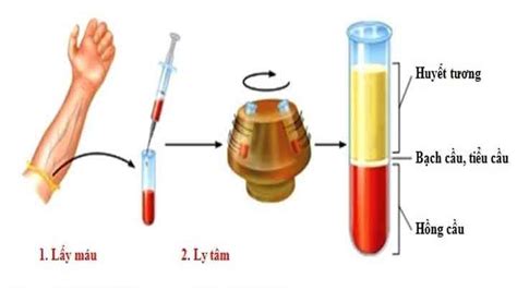 chuyển đảo huyết thanh là gì