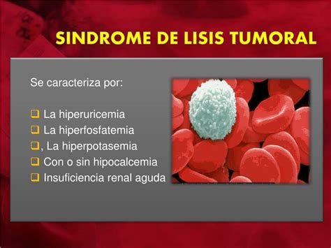 cid 10 lise tumoral