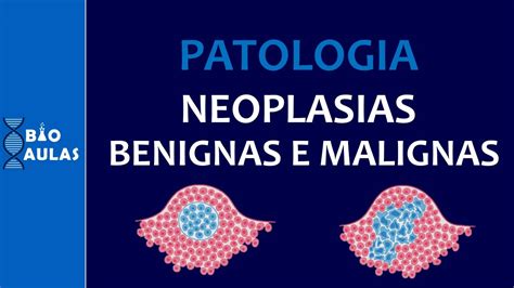cid neoplasia maligna de endometrio