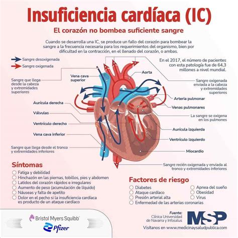cie 10 de insuficiencia cardiaca